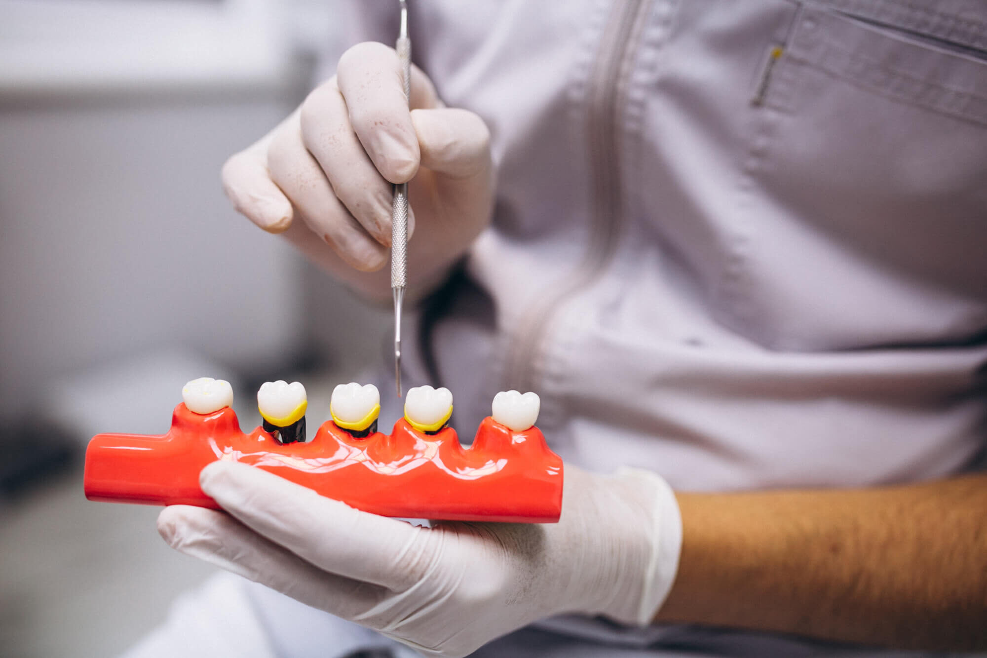 Caring for Dental Crowns